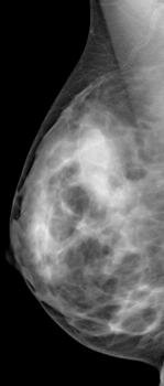 Qu'est-ce que le cancer ? Qu'est-ce que le cancer ?